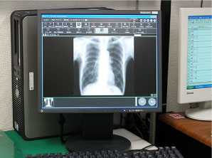 CRレントゲン（診断部）